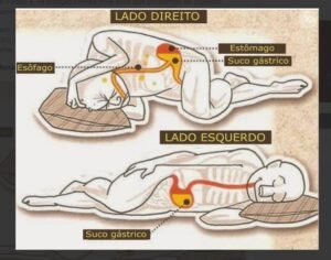 Por que dormir do lado esquerdo pode salvar a vida de uma pessoa?