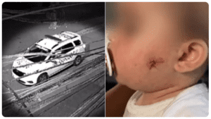 PM de SP afasta dois agentes investigados por tiro de airsoft no rosto de bebê de 1 ano; vídeo gravou ação
