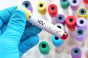 Infectologista diz que “é muito preocupante o aumento de casos de HIV em jovens”