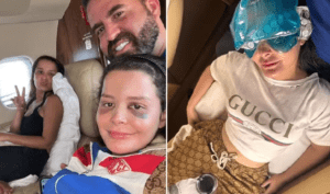 Maraísa posta foto de nariz quebrado e fala sobre acidente em piscina de resort em AL: ‘Era pra ser uma simples folga’