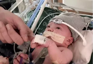 Transplante parcial de coração inédito em bebê é bem-sucedido