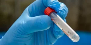 RS tem primeira morte por Dengue em 2024