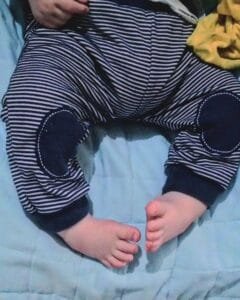 Família de Osório mobiliza redes sociais em busca de ajuda para cirurgia do bebê Bernardo, com pés tortos congênitos