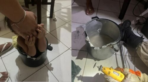 Criança é resgatada após entalar em panela de pressão
