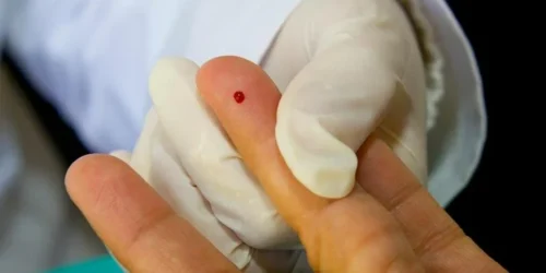 Professor é demitido por furar 45 alunos com a mesma agulha em “experimento” no Espírito Santo