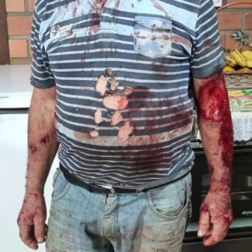 Agricultor aposentado teria sido atacado por puma em Barra do Ouro, distrito de Maquiné