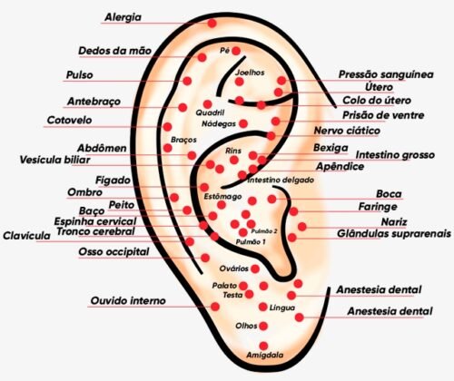 auriculoterapia 29865