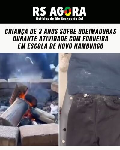 Uma criança de três anos sofreu queimaduras de segundo grau após cair em uma fogueira na Escola Municipal de Educação Infantil Caracol, em Novo Hamburgo