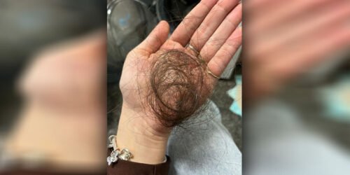 Família de jovem agredida na Praça das Carretas, em Osório, denuncia caso e quer responsabilização