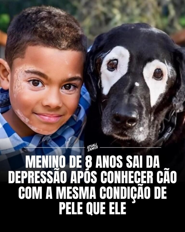 Menino de 8 anos sai da Depressão após conhecer cão com a mesma condição de pele que ele 4 3e446ee6 30bb 42ee 9701 c117f02fcdb4