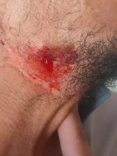 Motociclista fica ferido após atingir fios de internet baixos em Osório 3 611590373 25212679378403785 5499389387950827001 n