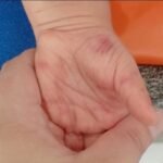 Prefeitura afasta Professoras após Denúncias de Maus-Tratos a Criança em Escola de Imbé