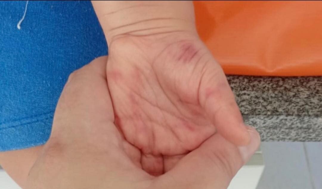 Prefeitura afasta Professoras ap&oacute;s Den&uacute;ncias de Maus-Tratos a Crian&ccedil;a em Escola de Imb&eacute;