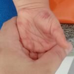 Professora é Presa Suspeita de Agredir Criança em Escola Infantil no Litoral Norte do RS