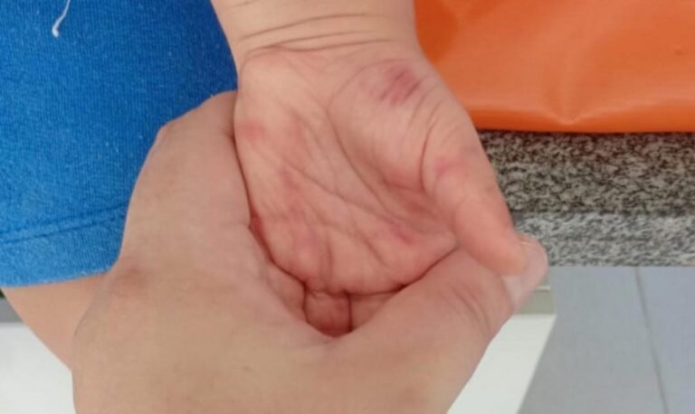 Professora é Presa Suspeita de Agredir Criança em Escola Infantil no Litoral Norte do RS 14 672327678 1655444455915101 2103009881947726743 n 1 e1776222586224