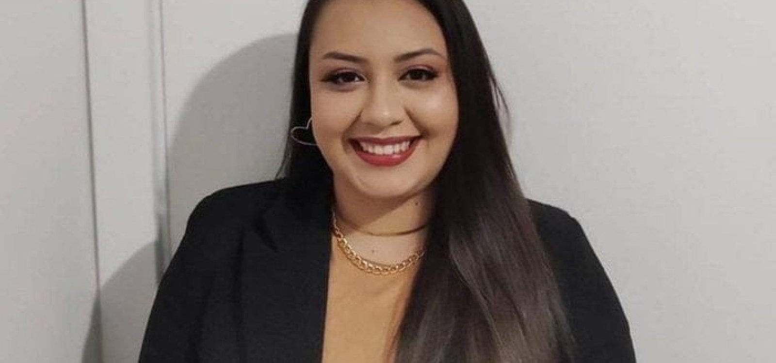 Jaqueline sofreu queimaduras no peito e no pescoço.
Arquivo pessoal / Arquivo pessoal