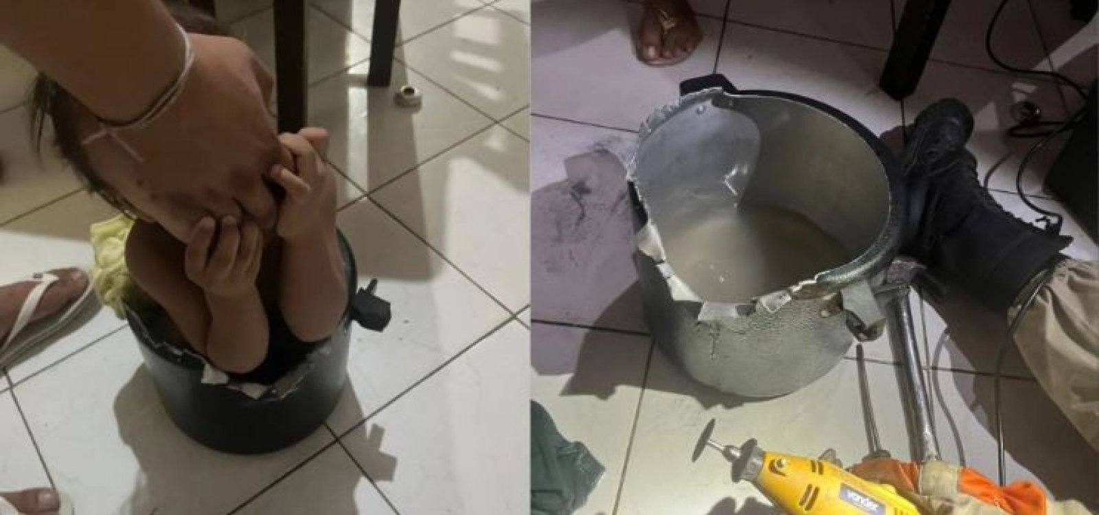 Bebê fica entalado em panela de pressão • Divulgação/Corpo de Bombeiros