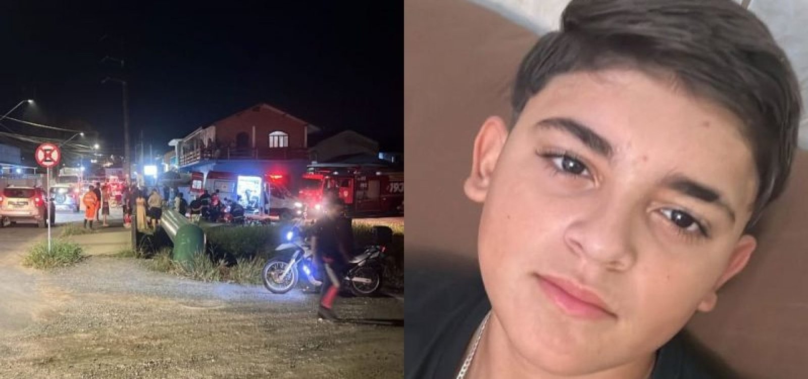 Adolescente fez 15 anos no dia que teve perna amputada.  – Foto: Internet/Reprodução/ND