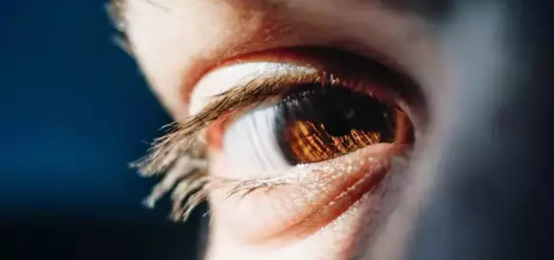 A Síndrome do Olho Seco é uma condição crônica que requer cuidados contínuos. (Foto: Unsplash)